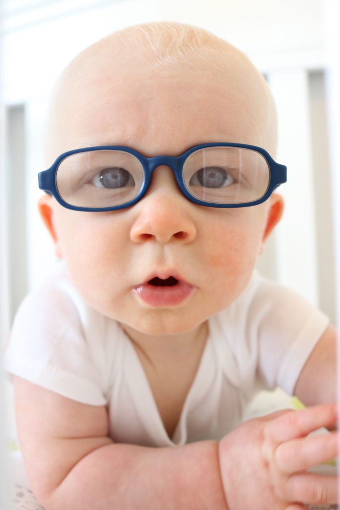 young child with albinism