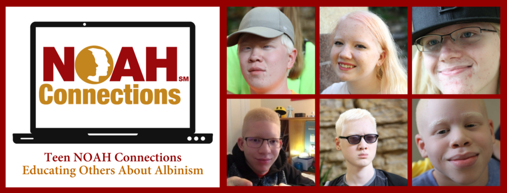 Teen NOAH Connections Educating Others About Albinism