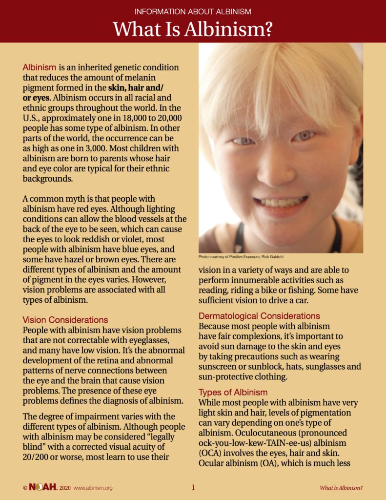 About Albinism And Hypopigmentation National Organization For 